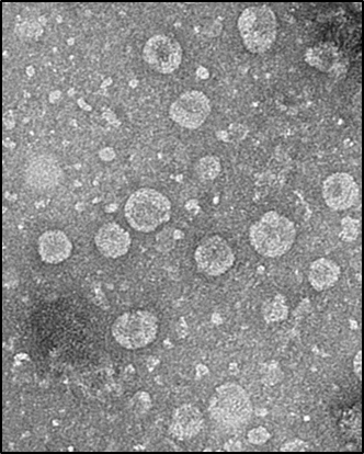 녹차유산균 엑소솜(L. plantarum exosome)_전자현미경촬영(Bio-TEM)